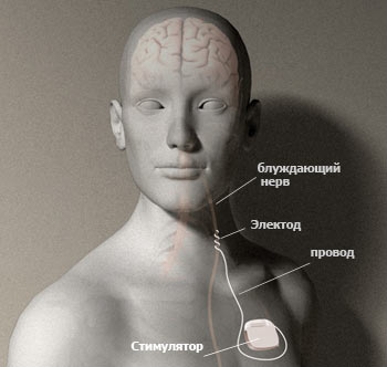 ���������� ����������� �����